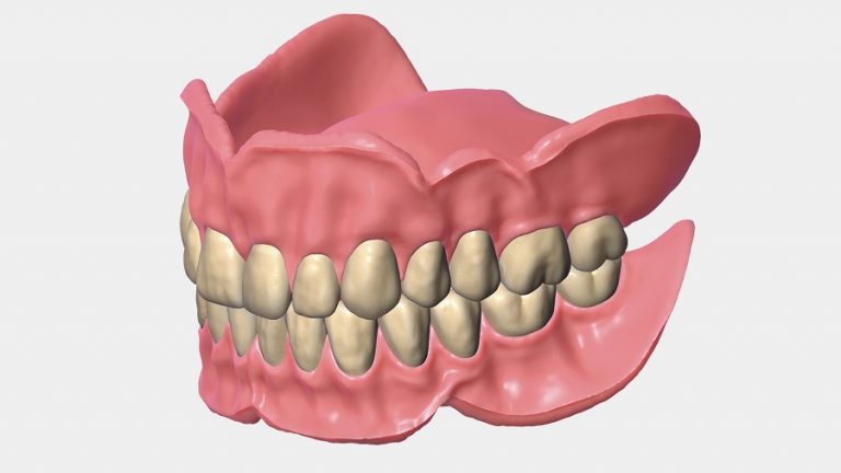 Opera System CAD by Exocad - GI Dental